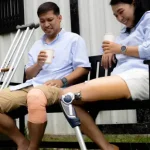 Best Accident Lawyers for Amputation and Life-Altering Injuries